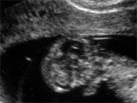 14. týden těhotenství 