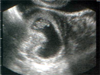9. týden těhotenství 